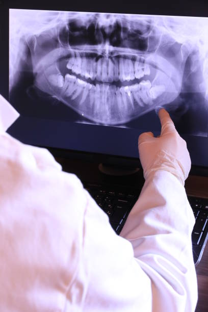 Best Emergency Wisdom Tooth Extraction in Savage, MD